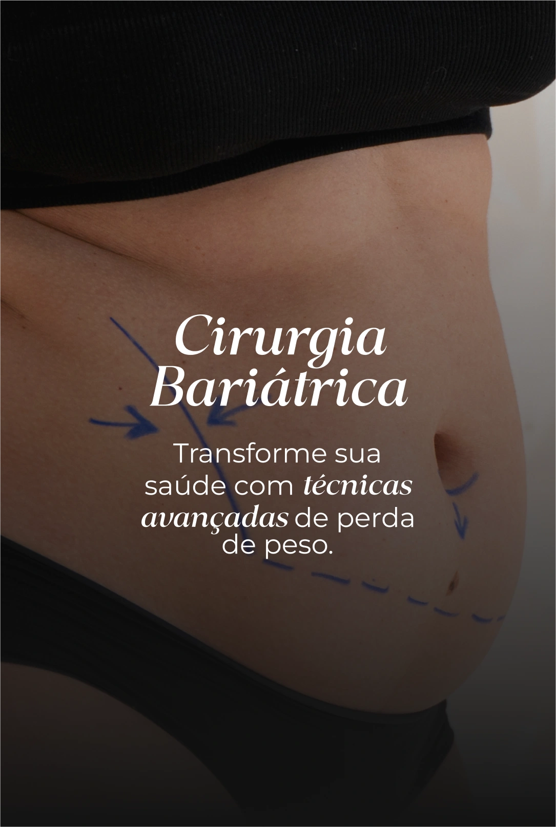 Cirurgia Bariátrica-(Compressify.io)